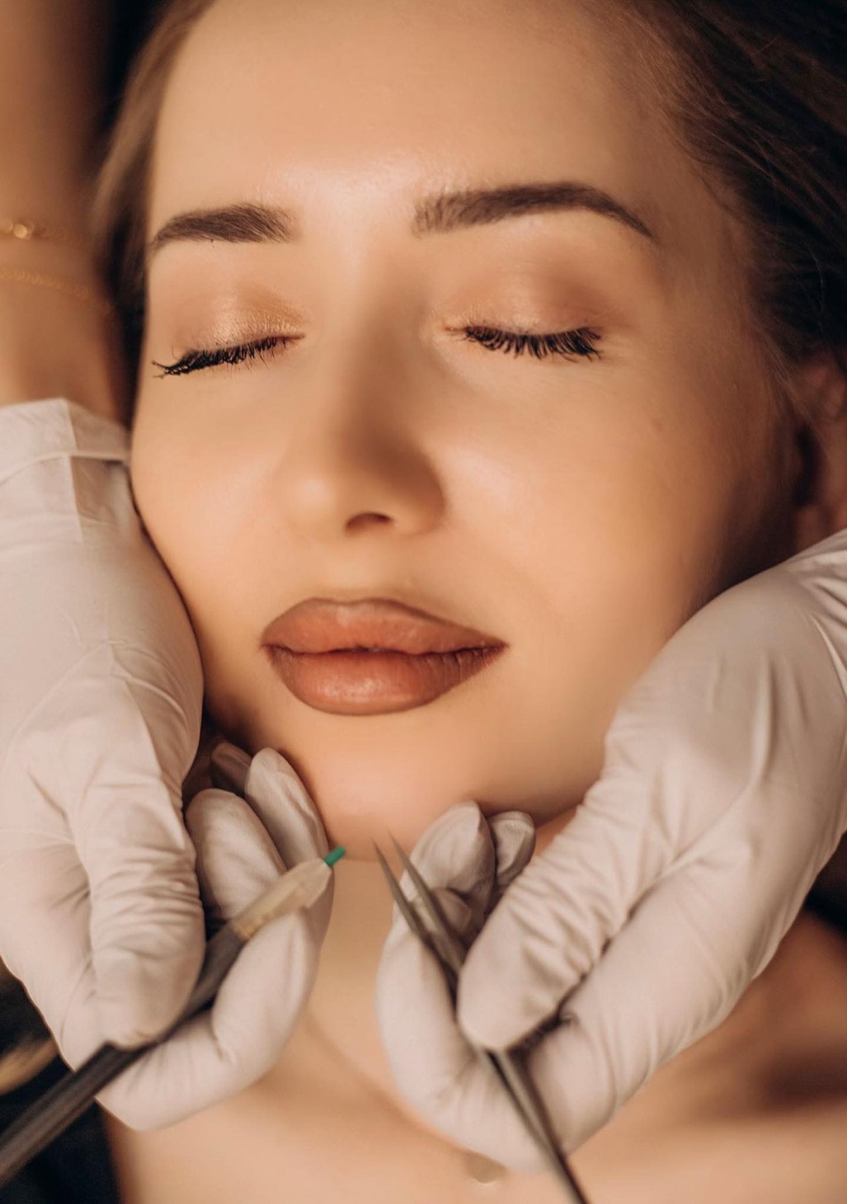 Professional Electrolysis Treatment