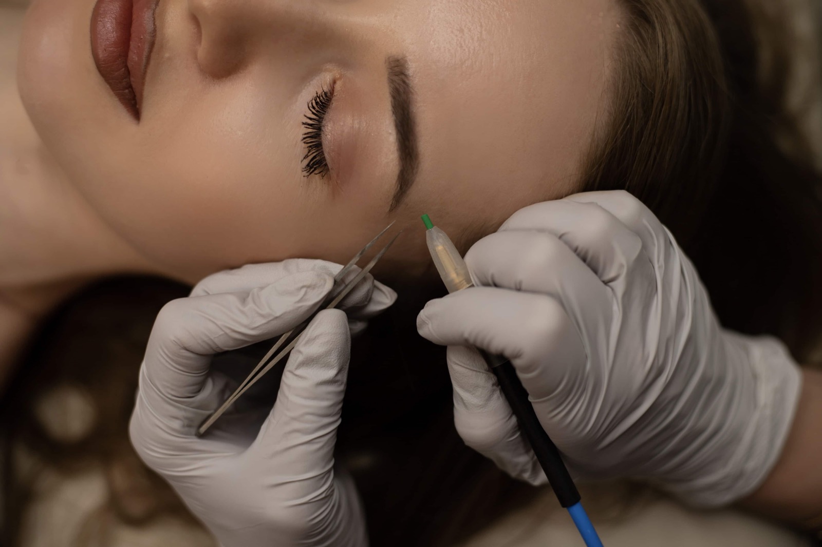 Electrolysis eyebrow treatment close-up