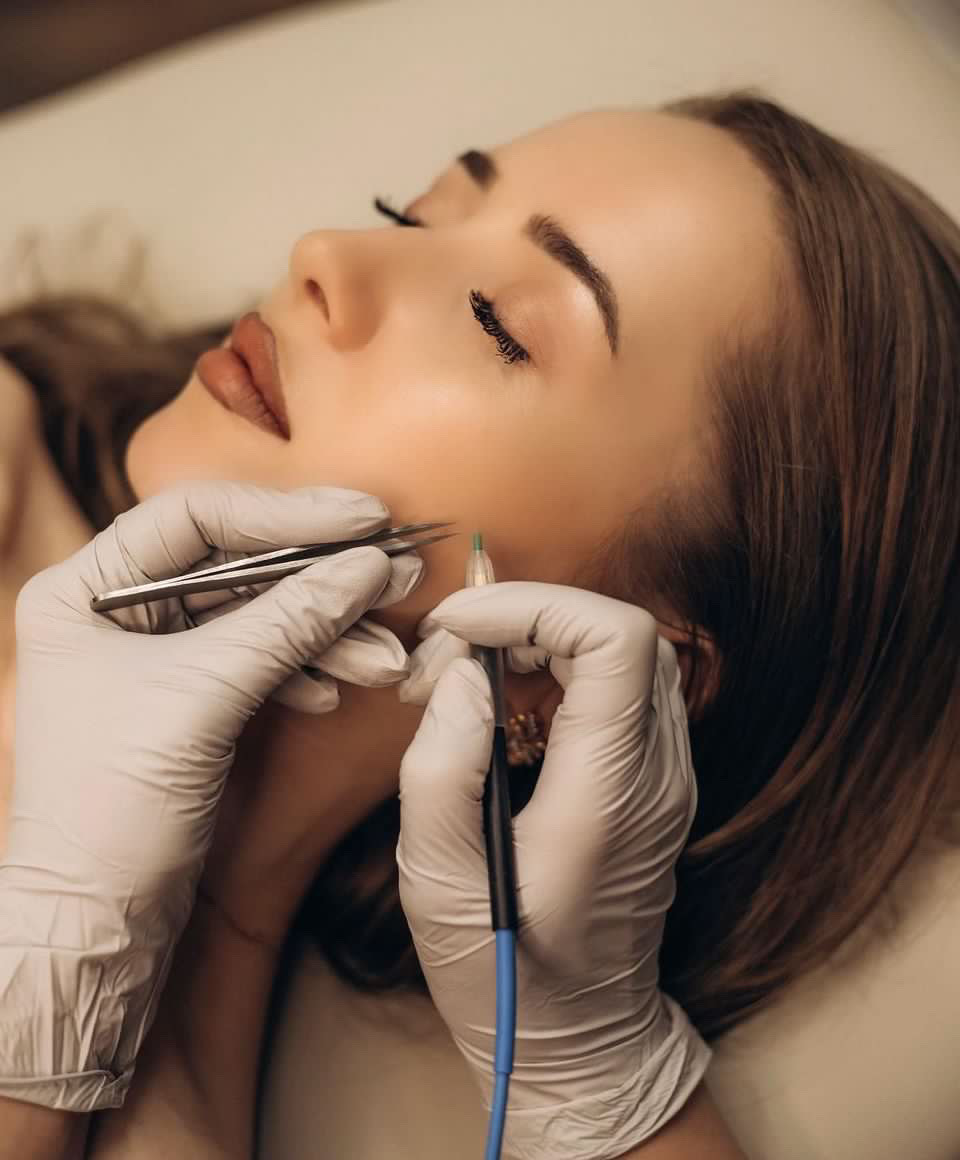 Electrolysis treatment close-up