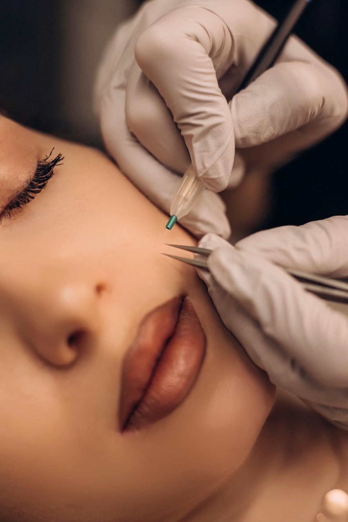 Precision electrolysis treatment